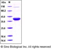 Sino Biological Human IL-8 / CXCL8 Protein (aa 23-99, Fc Tag) 100ug, Quantity: