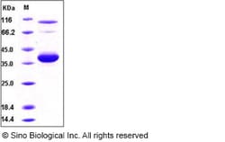 Sino Biological Recombinant Human IL-8/CXCL8 Protein (aa 28-99, hFc Tag),