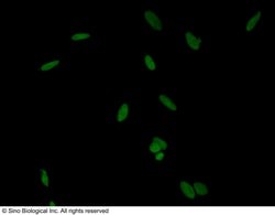 Sino Biological PARP-1 / PARP Antibody, Rabbit PAb, Antigen Affinity Purified