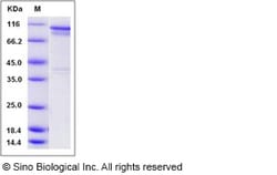 Sino Biological Recombinant Human S6K1/RPS6KB1 Protein (GST Tag), Quantity: