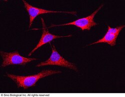 Sino Biological Anti-PLK4 Antibody, Rabbit Polyclonal, Quantity: Each of