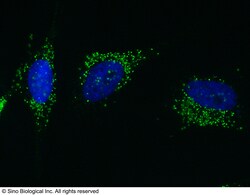 Sino Biological Anti-PML Antibody, Rabbit Polyclonal, Quantity: Each of