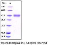 Sino Biological Recombinant Human CD84 Protein (His Tag), Quantity: Each