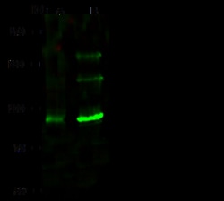 Sino Biological Anti-TLK1 Antibody, Rabbit Polyclonal, Quantity: Each of