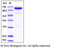 Sino Biological Human CD55 / DAF Protein (Fc Tag) 100ug, Quantity: Each
