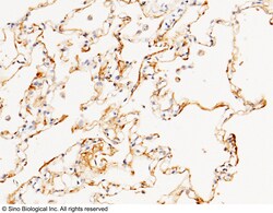 Sino Biological Anti-CD55/DAF Antibody, Rabbit Polyclonal, Quantity: Each
