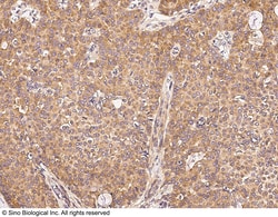Sino Biological Anti-UBE4A Antibody, Rabbit Polyclonal, Quantity: Each