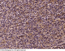 Sino Biological Anti-Vitamin D Receptor/VDR Antibody, Rabbit Polyclonal,