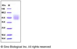 Sino Biological Recombinant Human CD34 Protein (His Tag), HPLC-verified,