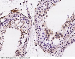 Sino Biological Anti-PKC alpha/PRKCA Antibody, Rabbit Polyclonal, Quantity: