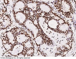 Sino Biological Anti-DNA-PKcs/PRKDC Antibody, Rabbit Polyclonal, Quantity: