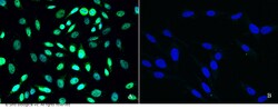 Sino Biological Anti-PRMT6 Antibody, Rabbit Polyclonal, Quantity: Each