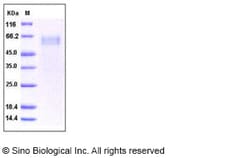 Sino Biological Recombinant Human ST2/IL-1 RL1 Protein, Quantity: Each