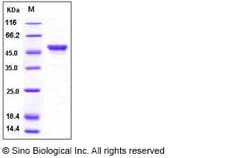 Sino Biological Human Carbonic Anhydrase IX / CA9 Protein (His Tag) 100ug,