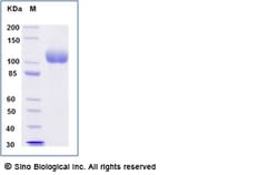 Sino Biological Recombinant Human ACE2 Protein (His Tag), HPLC-verified,
