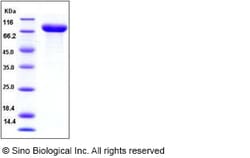 Sino Biological Recombinant Human IL1R2 Protein (hFc Tag), Quantity: Each