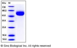 Sino Biological Recombinant Human IL1R2 Protein (ECD, His Tag), HPLC-verified,