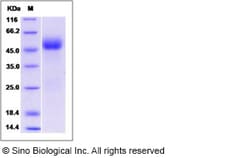 Sino Biological Human IL1R2 / IL1RB / CD121b Protein 100ug, Quantity: Each