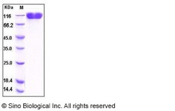 Sino Biological Human VCAM-1 / CD106 Protein (His Tag) 100ug, Quantity: