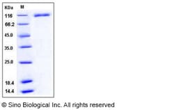 Sino Biological Recombinant Human VCAM-1/CD106 Protein (His Tag), Quantity: