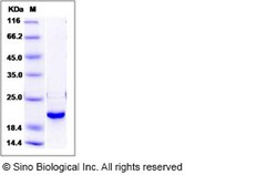 Sino Biological Human DUSP3 / VHR Protein 100ug, Quantity: Each of 1