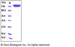 Sino Biological Recombinant Human CD146/MCAM Protein (hFc Tag), Quantity: