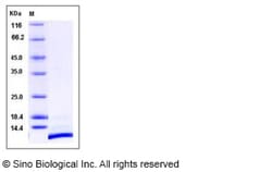 Sino Biological Recombinant Human SDF-1/CXCL12 Protein, Quantity: Each