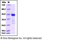 Sino Biological Human pro form of IL18 / Interleukin 18 / IGIF Protein
