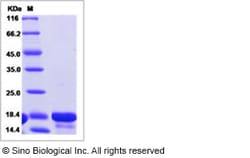 Sino Biological Human IL18 / IL-18 Protein 100ug, Quantity: Each of 1