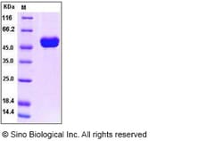 Sino Biological Human IL-1RA / IL1RN Protein (Fc Tag) 50ug, Quantity: Each