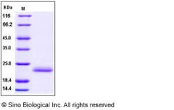 Sino Biological Recombinant Human IL-1 alpha/IL1A Protein, Quantity: Each