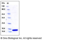 Sino Biological Recombinant Human FABP2 Protein (His Tag), HPLC-verified,