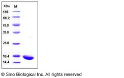 Sino Biological Recombinant Human IL-1 beta Protein, HPLC-verified, Quantity: