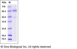 Sino Biological Recombinant Human TLR4 Protein (ECD, His Tag), Quantity: