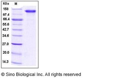 Sino Biological Human CD31 / PECAM1 Protein (Fc Tag) 100ug, Quantity: Each