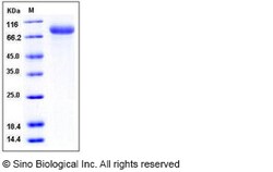 Sino Biological Human Endoglin / CD105 / ENG Protein (ECD, His Tag) 50ug,