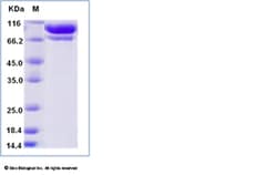 Sino Biological Recombinant Human Complement C2 Protein (His Tag), Quantity: