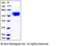 Sino Biological Recombinant Human IL1RAPL2 Protein (His Tag), HPLC-verified,