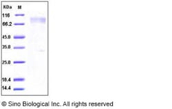 Sino Biological Recombinant Human M-CSFR/CSF1R Protein, Quantity: Each