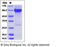Sino Biological Recombinant Human IGF1R Protein (His & GST Tag), Quantity: