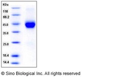 Sino Biological Recombinant Human Cystatin F/CST7 Protein (His Tag), Quantity: