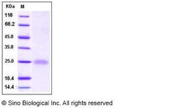 Sino Biological Recombinant Human Cystatin F/CST7 Protein, Quantity: Each
