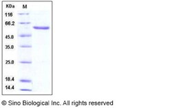 Sino Biological Human NBL1 / DAND1 / DAN Protein (Fc Tag) 100ug, Quantity: