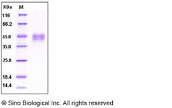 Sino Biological Recombinant Human DKK-1 Protein (His Tag), HPLC-verified,