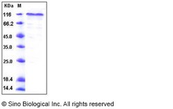 Sino Biological Human COMP Protein (His Tag) 100ug, Quantity: Each of 1