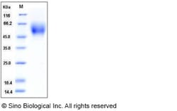 Sino Biological Recombinant Human DR6/TNFRSF21 Protein (His Tag), HPLC-verified,