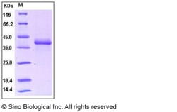 Sino Biological Recombinant Human S100A1 Protein (hFc Tag), Quantity: Each