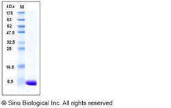 Sino Biological Recombinant Human S100A1 Protein, Quantity: Each of 1