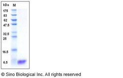 Sino Biological Recombinant Human S100A2 Protein, Quantity: Each of 1