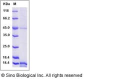 Sino Biological Recombinant Human Prokineticin 1/EG-VEGF Protein (His Tag),